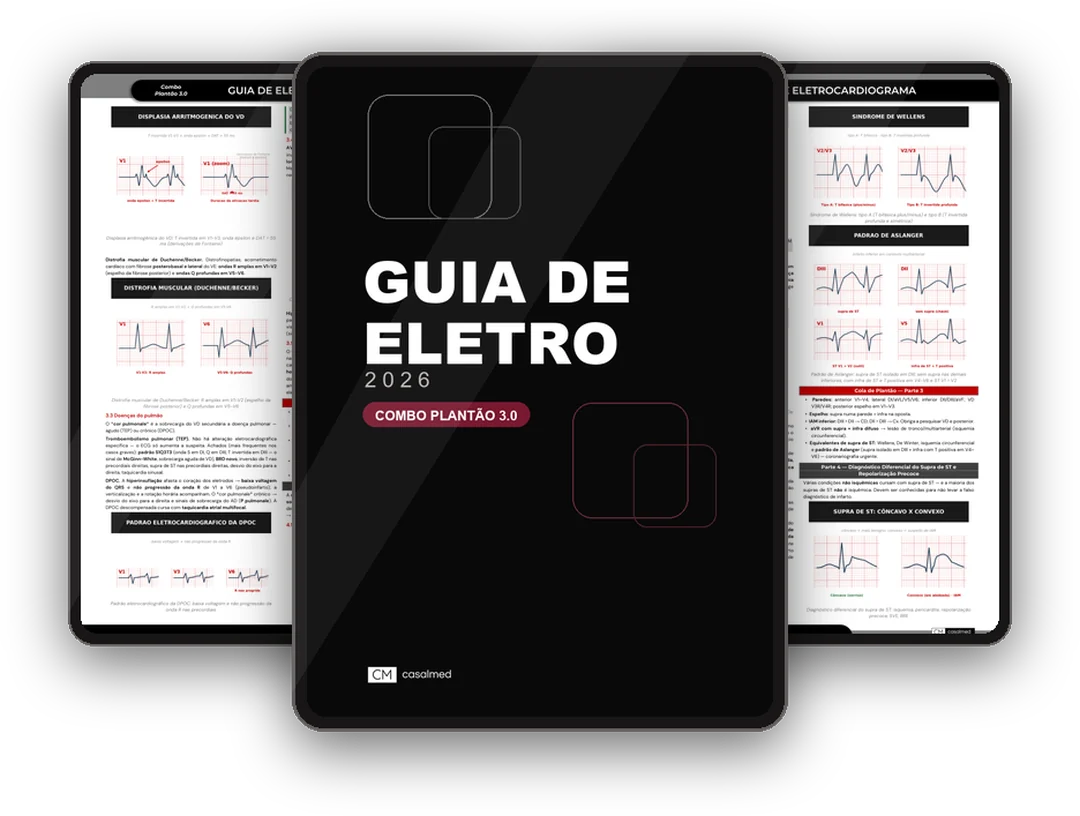 Guia de Eletrocardiograma